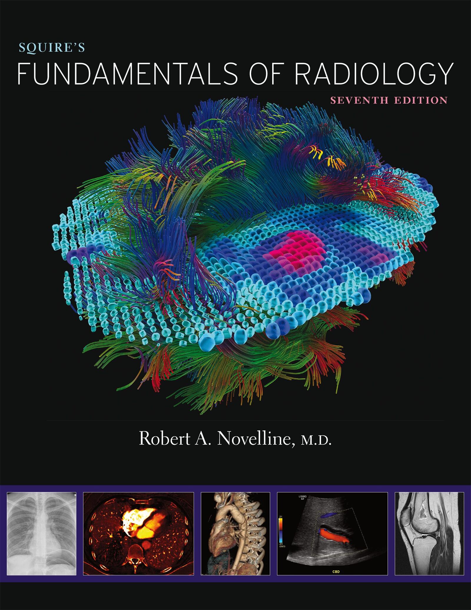 Squire’s Fundamentals of Radiology — Harvard University Press